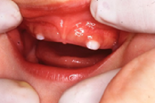 乳歯の生える時期と順序02